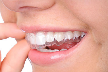Clinica dental especialista en ortodoncia invisible