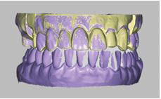 Tecnología dental 3d