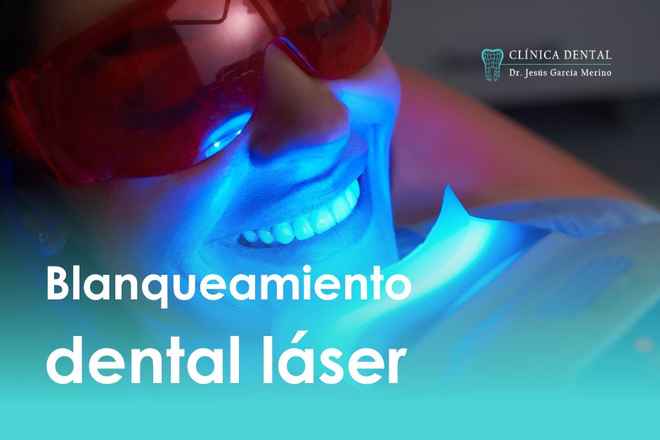 blanqueamiento dental laser jaen clinica dental dentista profesional jesus garcia merino