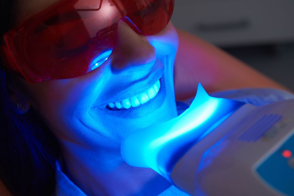 blanqueamiento dental laser jaen clinica dntal dentista profesional jesus garcia merino