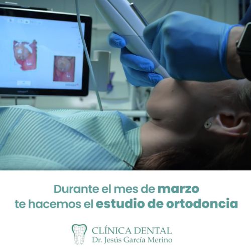 promocion marzo 2023 clinica dental jaen