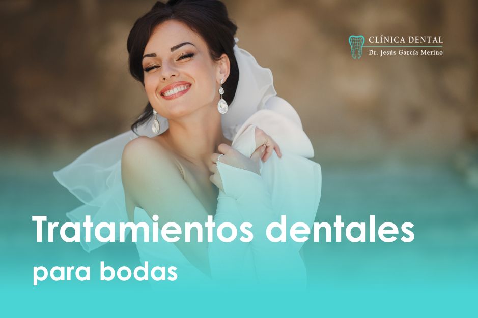 tratamientos dentales para bodas clinica dental jaen dr jesus garcia merino