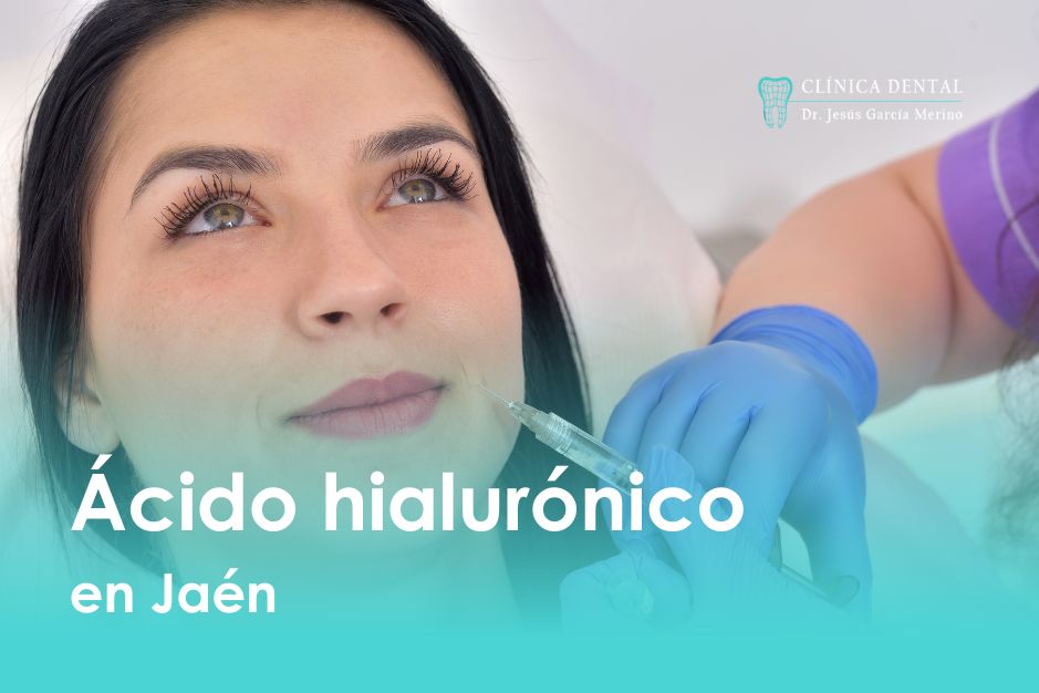 Ácido hialurónico labios en Jaén Clínica dental Jaen Dr. Jesús Garcia Merino