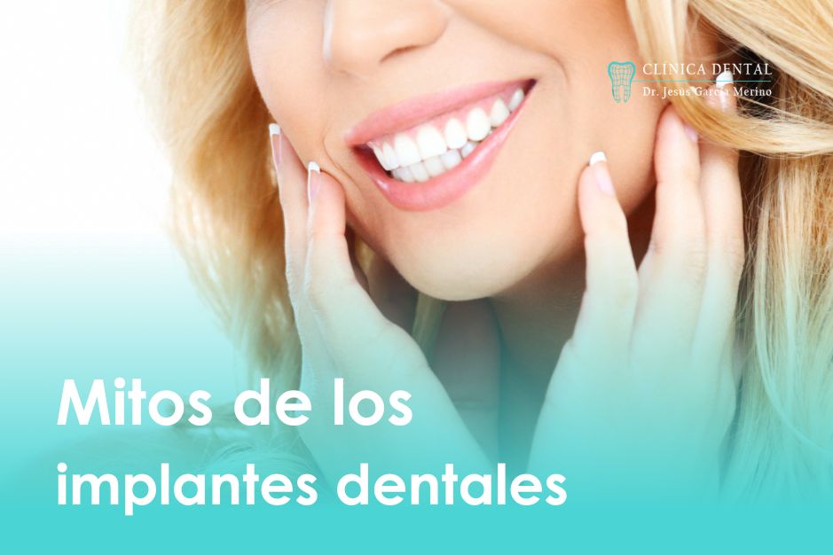 Mitos de los Implantes dentales Jaén Clinica dental Jaén Jesus garcía merino