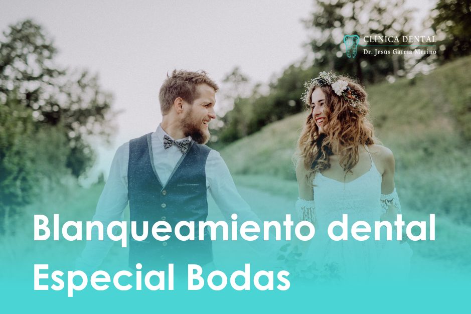Blanqueamiento dental, especial bodas tratamientos clinica dental jaen dr. Jesús García Merino