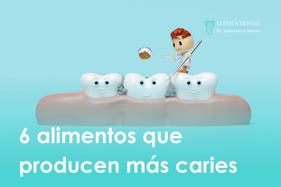 alimentos que producen más caries Clinica dental Jaen Dr. Jesús García Merino dentista