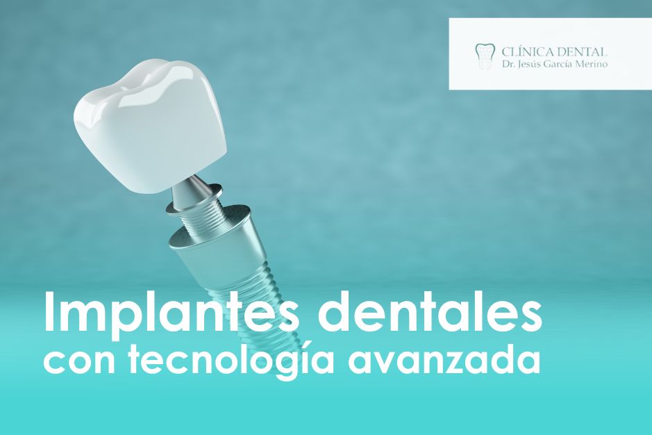 implantes dentales jaen clinica dental dr jesus garcia merino