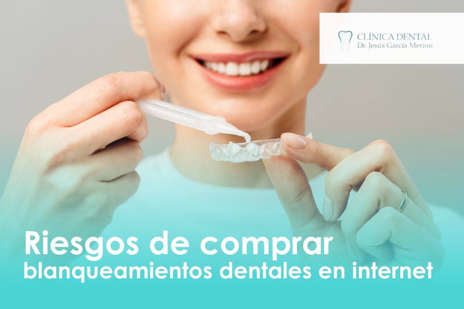 riesgos de comprar blanqueamientos dentales en internet clinica dental jaen