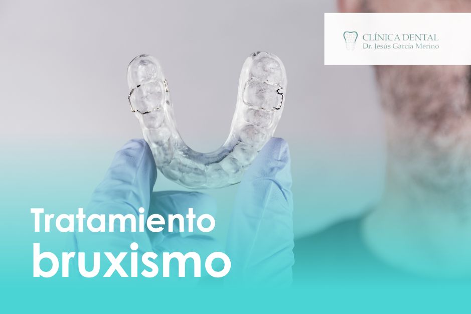 Los mejores tratamientos para el bruxismo en Jaén clinica dental dentista