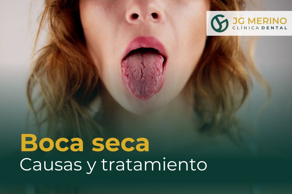 Boca seca causas y tratamiento en Jaén Clinica Dental dentista