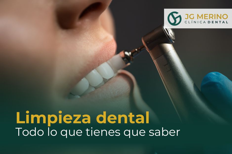 Limpieza dental en Jaén Clinica dental dentista DR Jesus García Merino precio