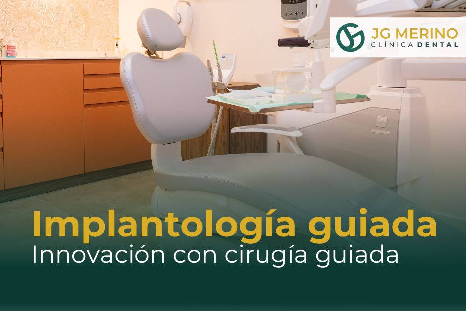 Implantología guiada en Jaén Implantes dentales experiencia Dr. Jesús García Merino