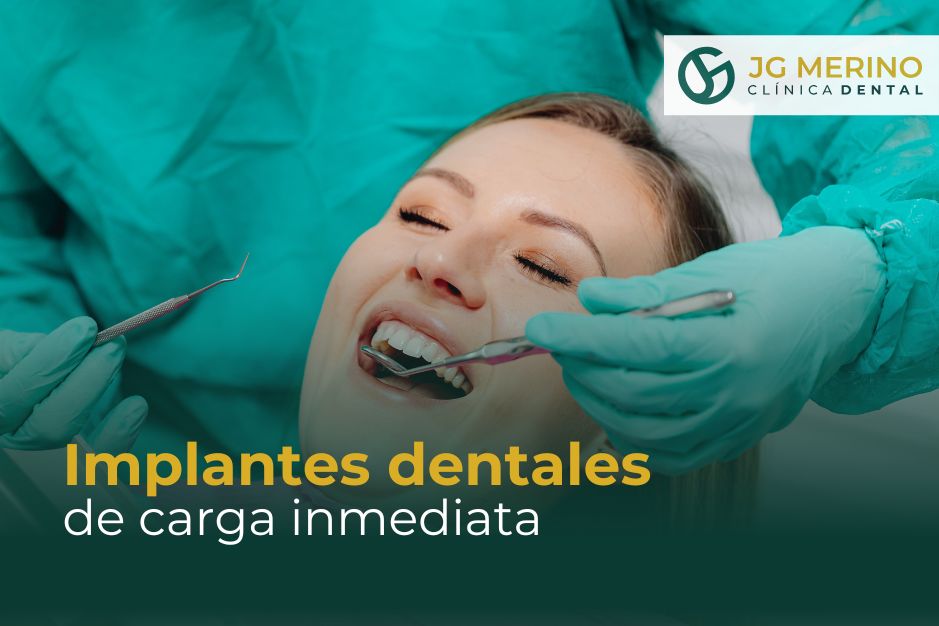 Implantes de carga inmediata en Jaén implantologia dr jesus garcia merino clinica dental dentista