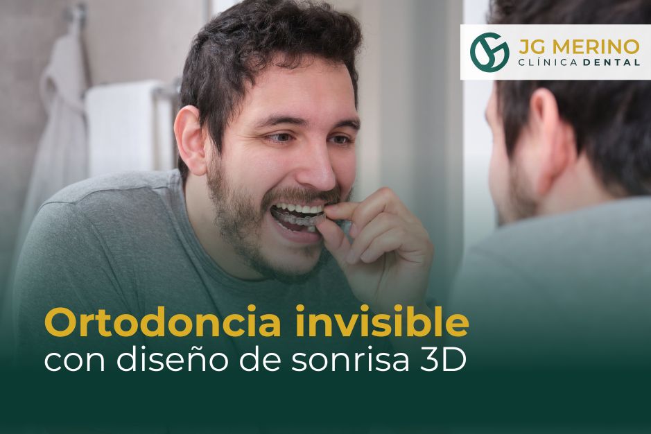 Ortodoncia Invisible en Jaén diseño de sonrisa 3D clinica dental jaen dr jesus garcía merino