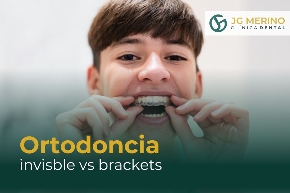 Beneficios de la ortodoncia invisible frente a la ortodoncia con brackets Clinica dental jaen dr jesus garcia merino