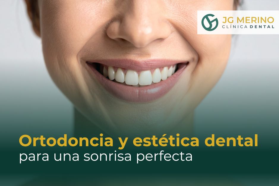 Beneficios de combinar ortodoncia y estética dental para una sonrisa perfecta Clinica dental Jaén