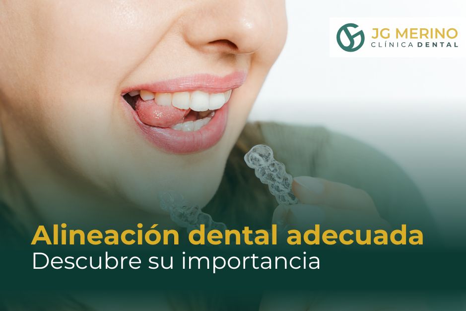 La importancia de una alineación dental adecuada Clinica Dental Jaen Dr Jesus García Merino dentista ortodoncia