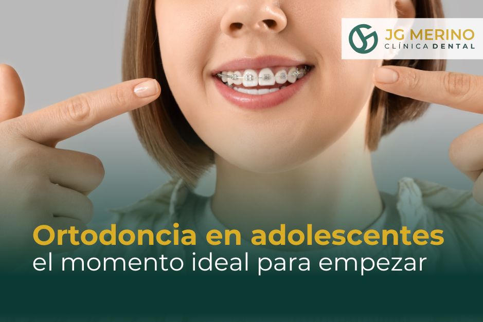 Ortodoncia en adolescentes el momento ideal para empezar clinica dental jaen dentista