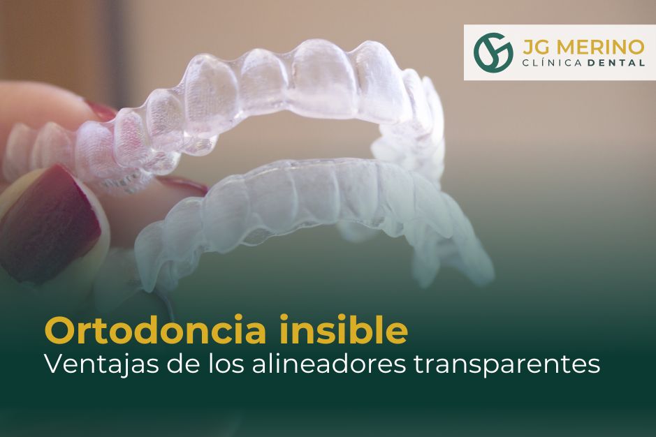 Ventajas de la ortodoncia invisible Clinica dental Jaen Dr Jesus Garcia Merino alineadores transparentes